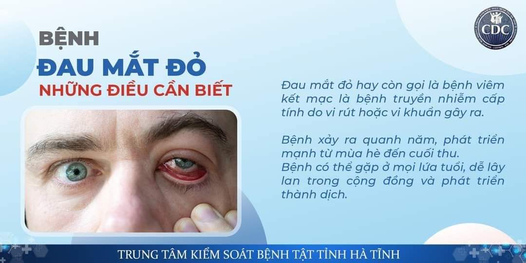 Những điều cần biết về bệnh đau mắt đỏ.